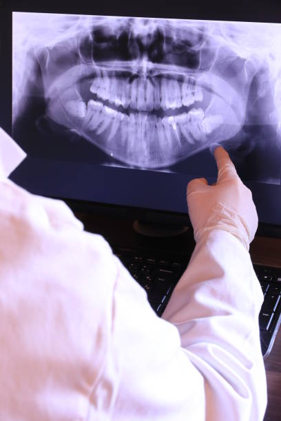 Best Emergency Cosmetic Dentistry (e.g., broken veneers) in Chico, CA